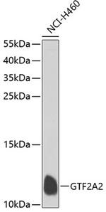 GTF2A2 Polyclonal Antibody