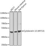 Cytokeratin 13 Polyclonal Antibody