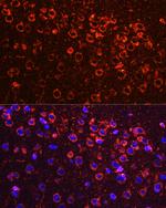 YBX1 Antibody in Immunohistochemistry (Paraffin) (IHC (P))