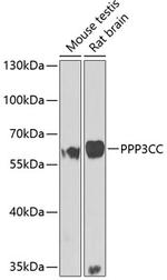 PPP3CC Antibody in Western Blot (WB)