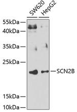 SCN2B Polyclonal Antibody