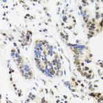 TOP1 Antibody in Immunohistochemistry (Paraffin) (IHC (P))
