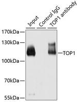TOP1 Antibody in Immunoprecipitation (IP)