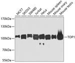 TOP1 Antibody in Western Blot (WB)