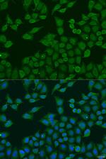 PLA2G4C Polyclonal Antibody