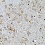 NAT8 Antibody in Immunohistochemistry (Paraffin) (IHC (P))
