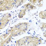 PSTPIP1 Polyclonal Antibody