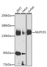 NUP155 Polyclonal Antibody