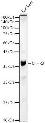 CFHR3 Antibody in Western Blot (WB)