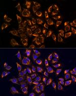CKAP4 Antibody in Immunocytochemistry (ICC/IF)