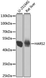 HARS2 Polyclonal Antibody