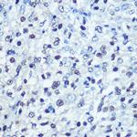 SAMHD1 Polyclonal Antibody