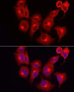 SKIP Antibody in Immunocytochemistry (ICC/IF)