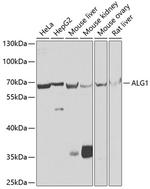 ALG1 Polyclonal Antibody