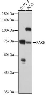 PAK6 Polyclonal Antibody