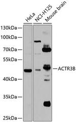 ACTR3B Polyclonal Antibody