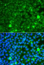 GBA3 Polyclonal Antibody