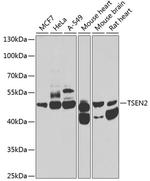 TSEN2 Polyclonal Antibody