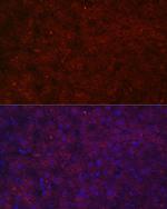 LRG1 Antibody in Immunocytochemistry (ICC/IF)