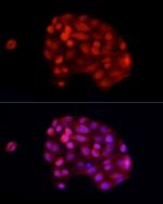 ADAR Polyclonal Antibody