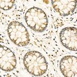 ADAR Antibody in Immunohistochemistry (Paraffin) (IHC (P))