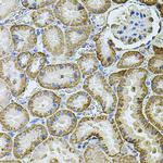 CDH16 Antibody in Immunohistochemistry (Paraffin) (IHC (P))