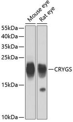 CRYGS Polyclonal Antibody