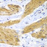 H-Ras Polyclonal Antibody