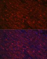 PGAM2 Antibody in Immunohistochemistry (Paraffin) (IHC (P))