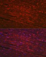 PGAM2 Polyclonal Antibody
