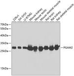 PGAM2 Antibody in Western Blot (WB)