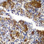AMPK beta-1 Antibody in Immunohistochemistry (Paraffin) (IHC (P))