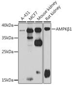 AMPK beta-1 Antibody in Western Blot (WB)