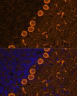 PKC gamma Polyclonal Antibody