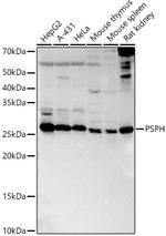PSPH Polyclonal Antibody