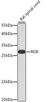 RGR Polyclonal Antibody