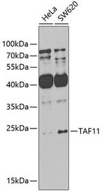 TAF11 Polyclonal Antibody