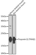 TNNI2 Polyclonal Antibody