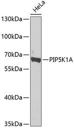 PIP5K1A Polyclonal Antibody