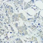 SOCS5 Polyclonal Antibody