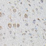 MTHFD1L Antibody in Immunohistochemistry (Paraffin) (IHC (P))