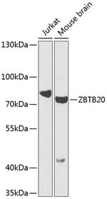 ZBTB20 Polyclonal Antibody