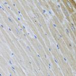 USP25 Antibody in Immunohistochemistry (Paraffin) (IHC (P))