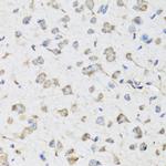 USP25 Antibody in Immunohistochemistry (Paraffin) (IHC (P))