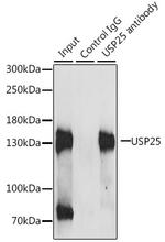 USP25 Antibody in Immunoprecipitation (IP)