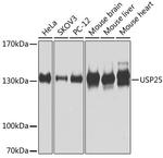 USP25 Antibody in Western Blot (WB)