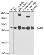 RAB23 Polyclonal Antibody