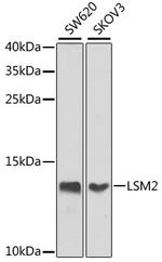LSM2 Polyclonal Antibody