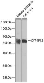 CYP4F12 Polyclonal Antibody