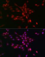 PHD3 Polyclonal Antibody